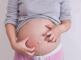 Dị ứng thai kỳ và những thông tin quan trọng các mẹ cần biết